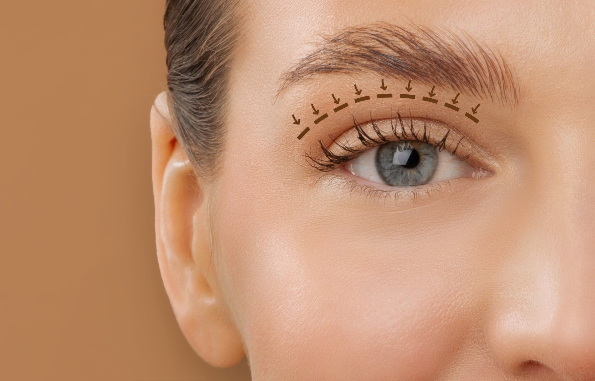 Blefaroplastia - Cirurgia de pálpebras com Dra Luciana Sendra